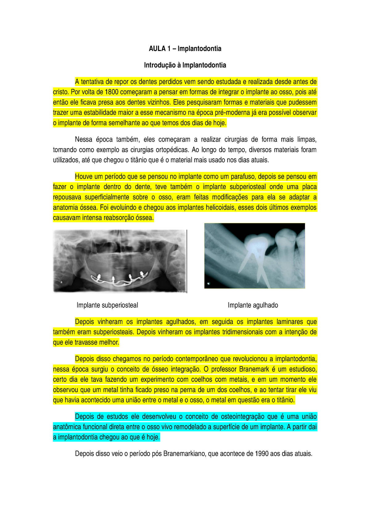 Aula 1 Implanto Aula Implantodontia Implantodontia Tentativa De Repor Os Dentes Studocu