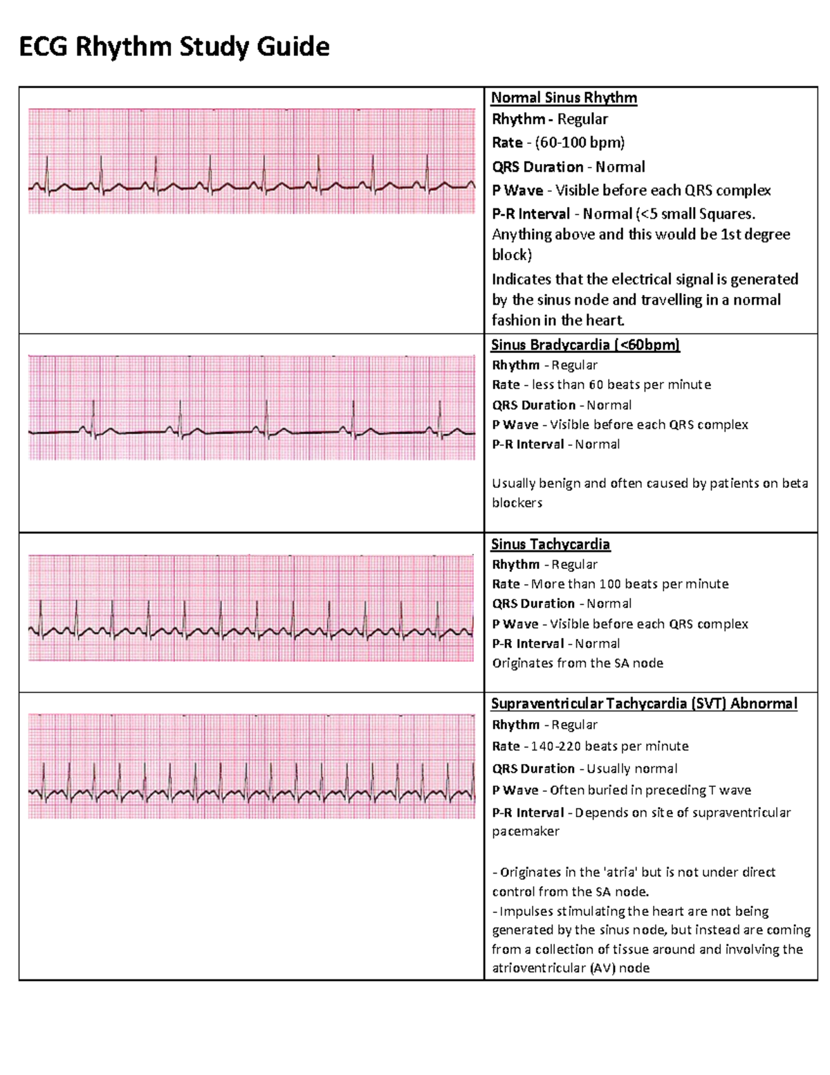 1ECG Rythum Study Guide - ECG Rhythm Study Guide Normal Sinus Rhythm ...