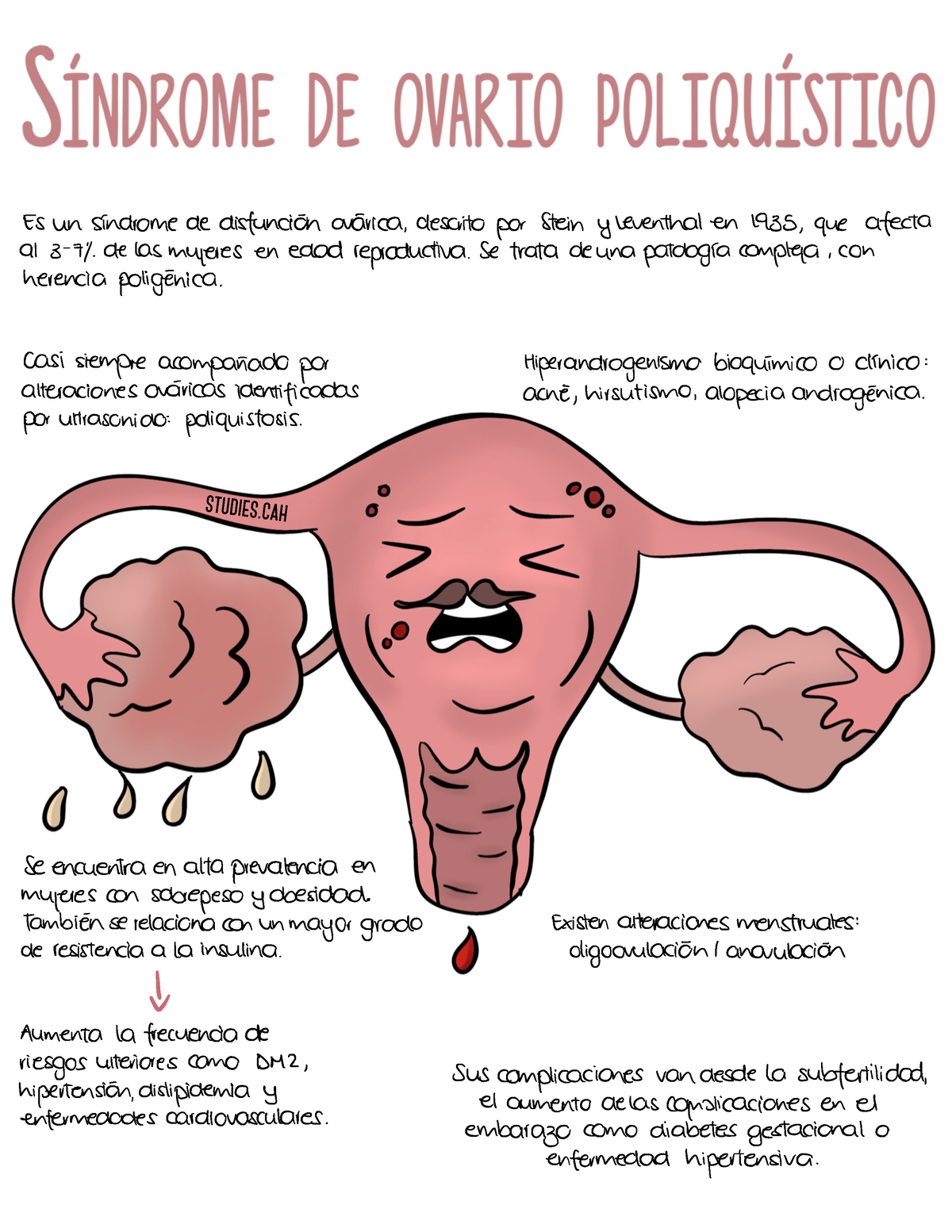 Síndrome De Ovario Poliquístico Es Un Síndrome De Disfunción Ovárica Descrito Por Stein Y 6704
