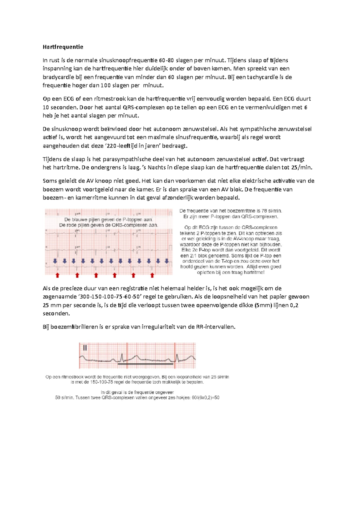 Hartritme Op Het Ecg Hartfrequentie In Rust Is De Normale Sinusknoopfrequentie 60 80 Slagen Per Studeersnel