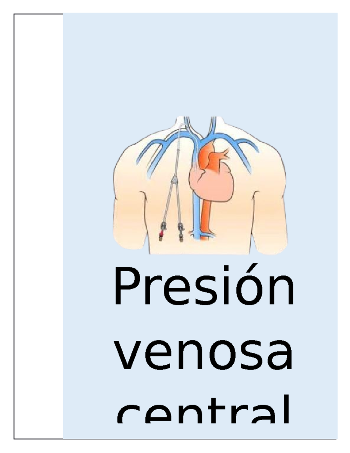 PVC Toma de presión venosa central Presión venosa central l. INTRODUCCIÓN ll. JUSTIFICACIÓN PVC Toma de presión venosa central Presión venosa central l. INTRODUCCIÓN ll. JUSTIFICACIÓN