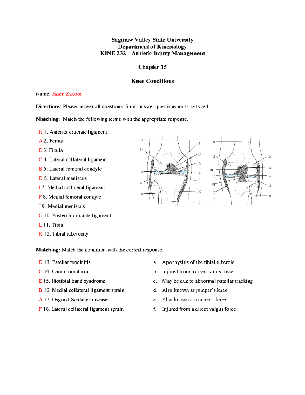 Chapter 15 - Knee Conditions - Saginaw Valley State University ...