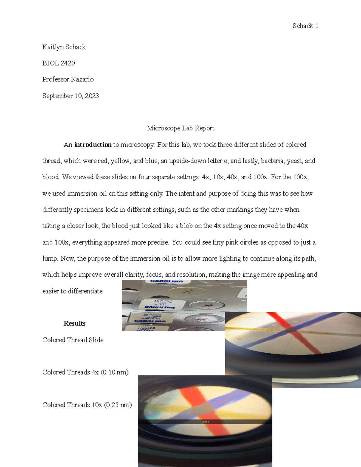 Microscope Lab Report Schack 1 Kaitlyn Schack BIOL 2420 Professor