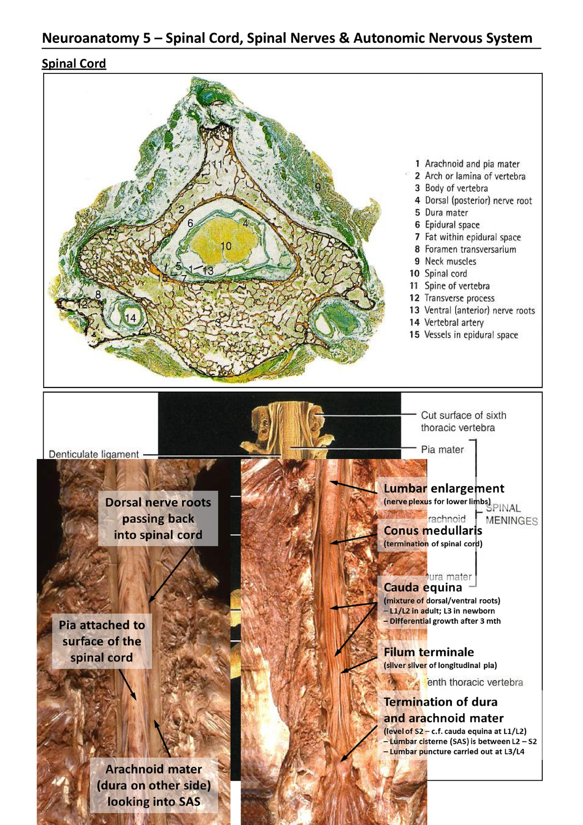 Neuroanatomy Lecture 4 Spinal Cord Part 2 Spinothalamic Tract ...