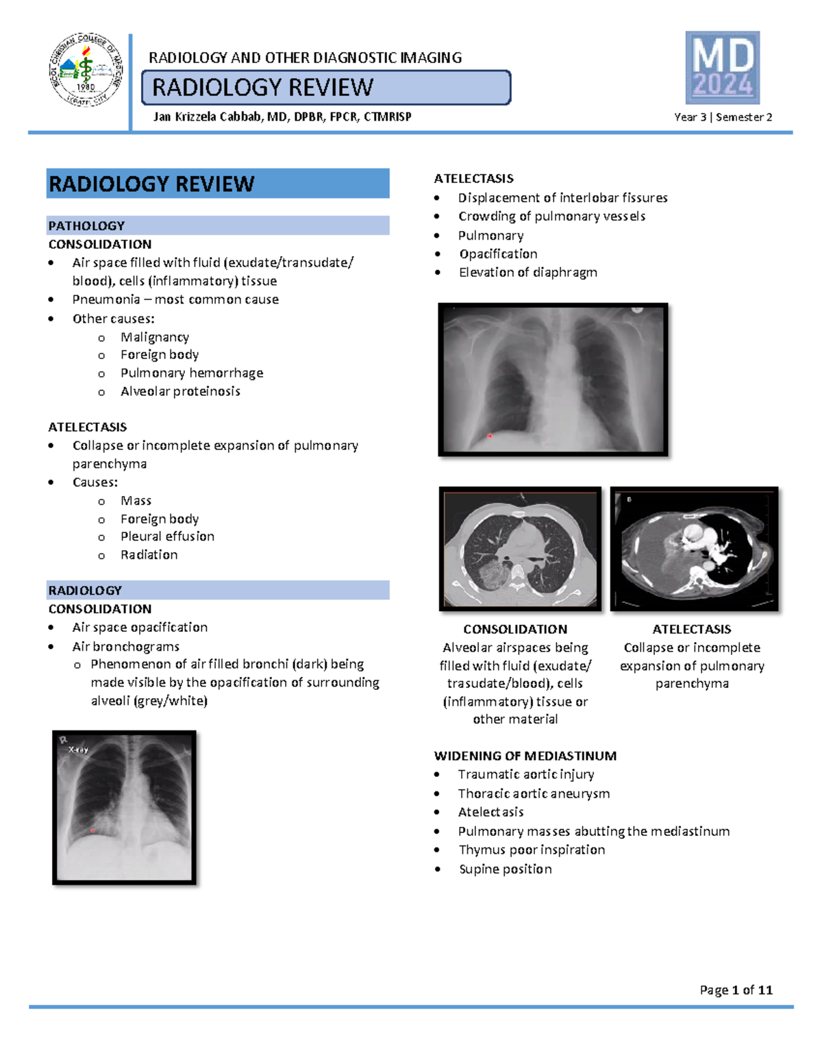 04. Radiology Review - RADIOLOGY REVIEW Jan Krizzela Cabbab, MD, DPBR ...