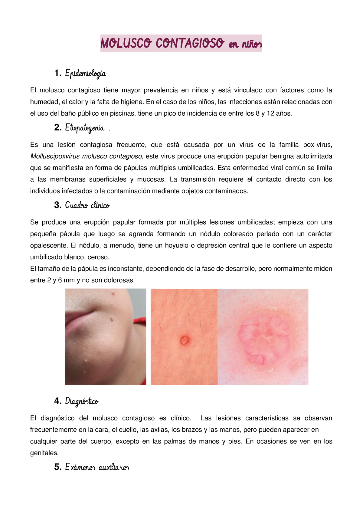 molusco contagioso en las manos