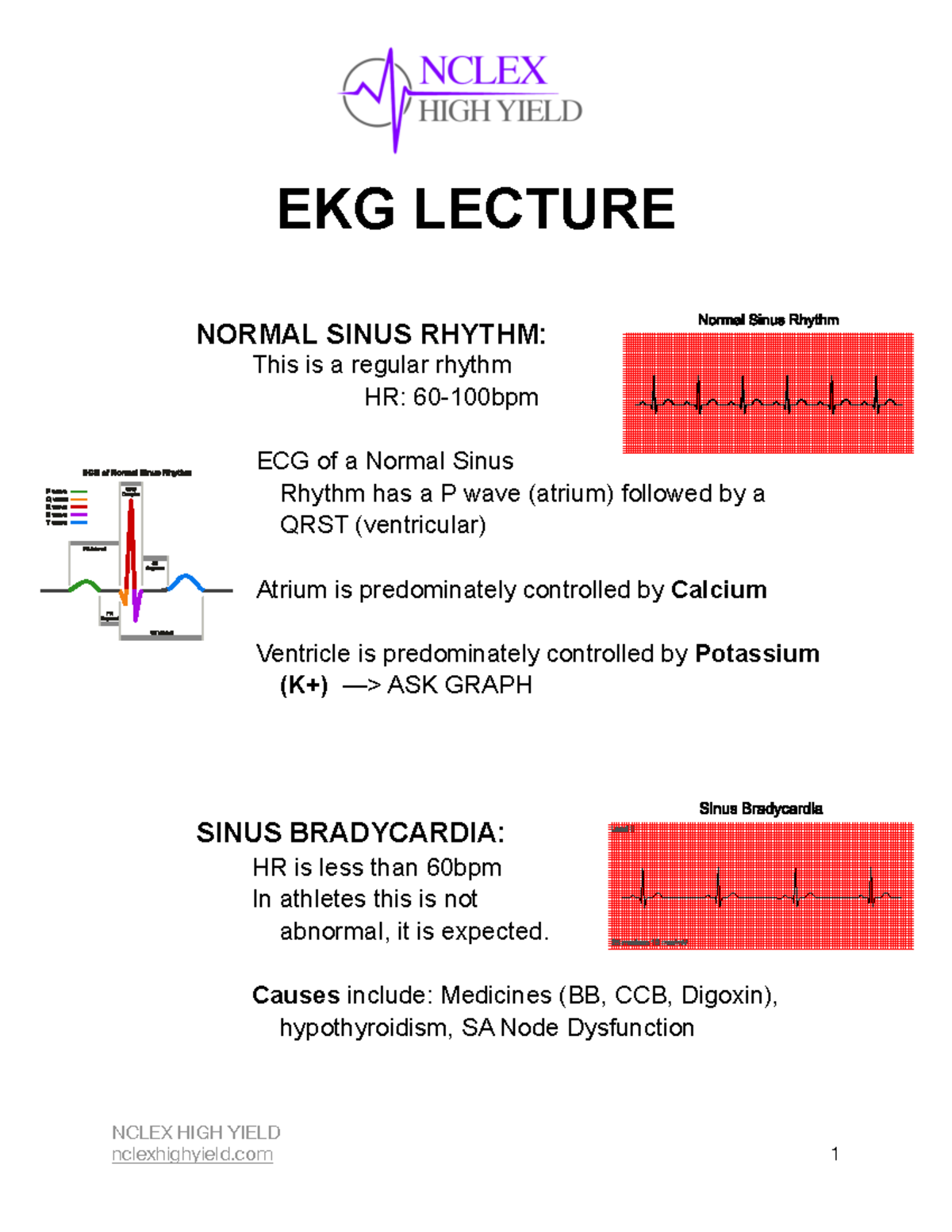 EKG Lecture Notes Final Feb 2023 - EKG LECTURE NORMAL SINUS RHYTHM ...