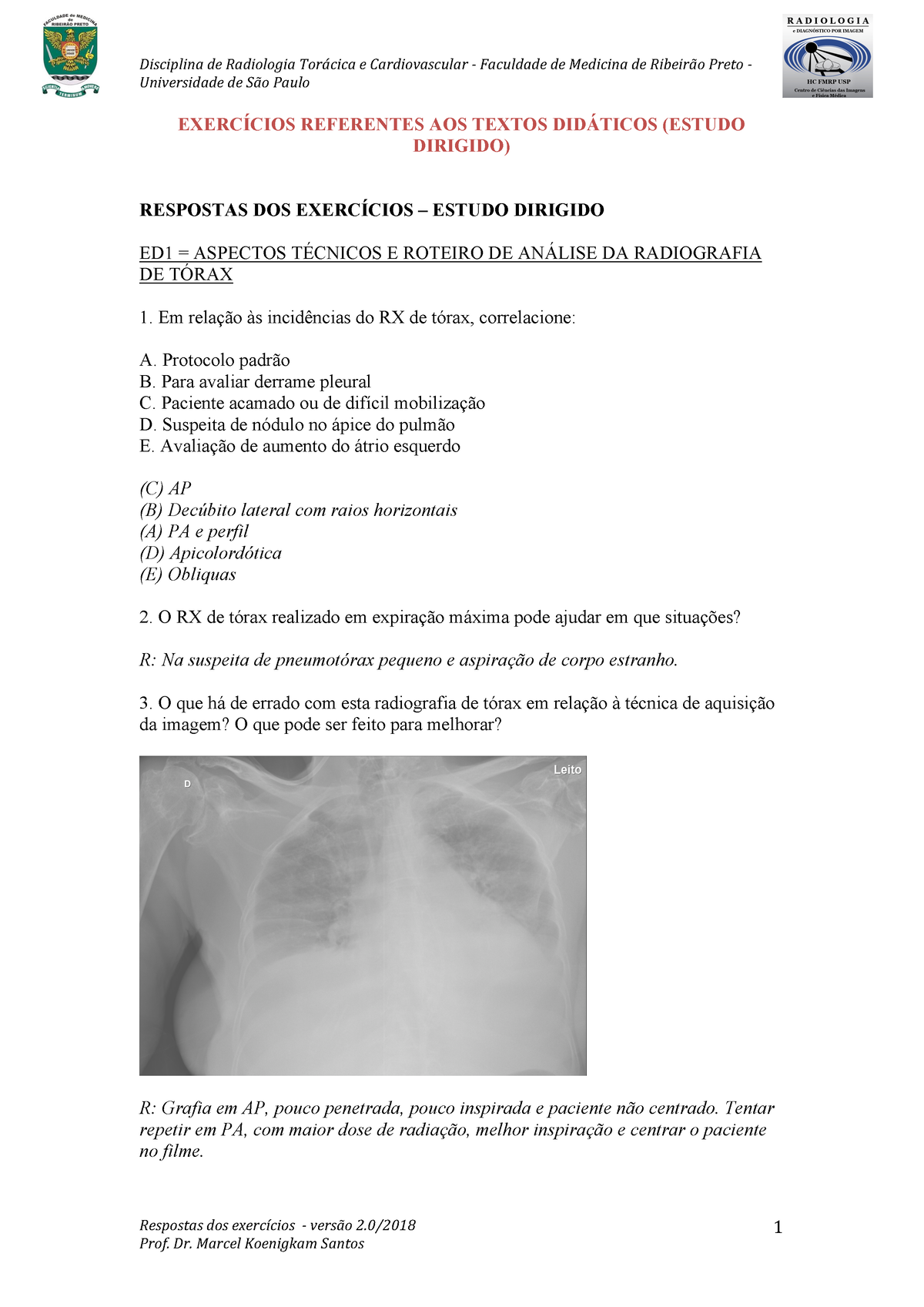 Resumo Aula 2 Turbina - hwbsos - AULA 2 - COMO PERDER SUA POCHETE E TER UM  ABDOMEN DEFINIDO - Studocu