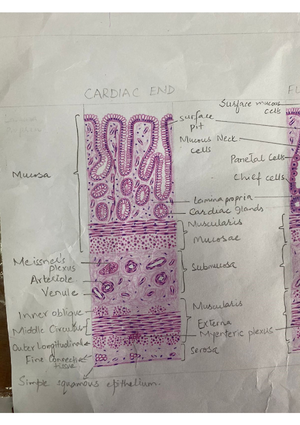 Case Study꞉ Carpal Tunnel Syndrome – 1st Year, Module 1 - Carpal Tunnel ...