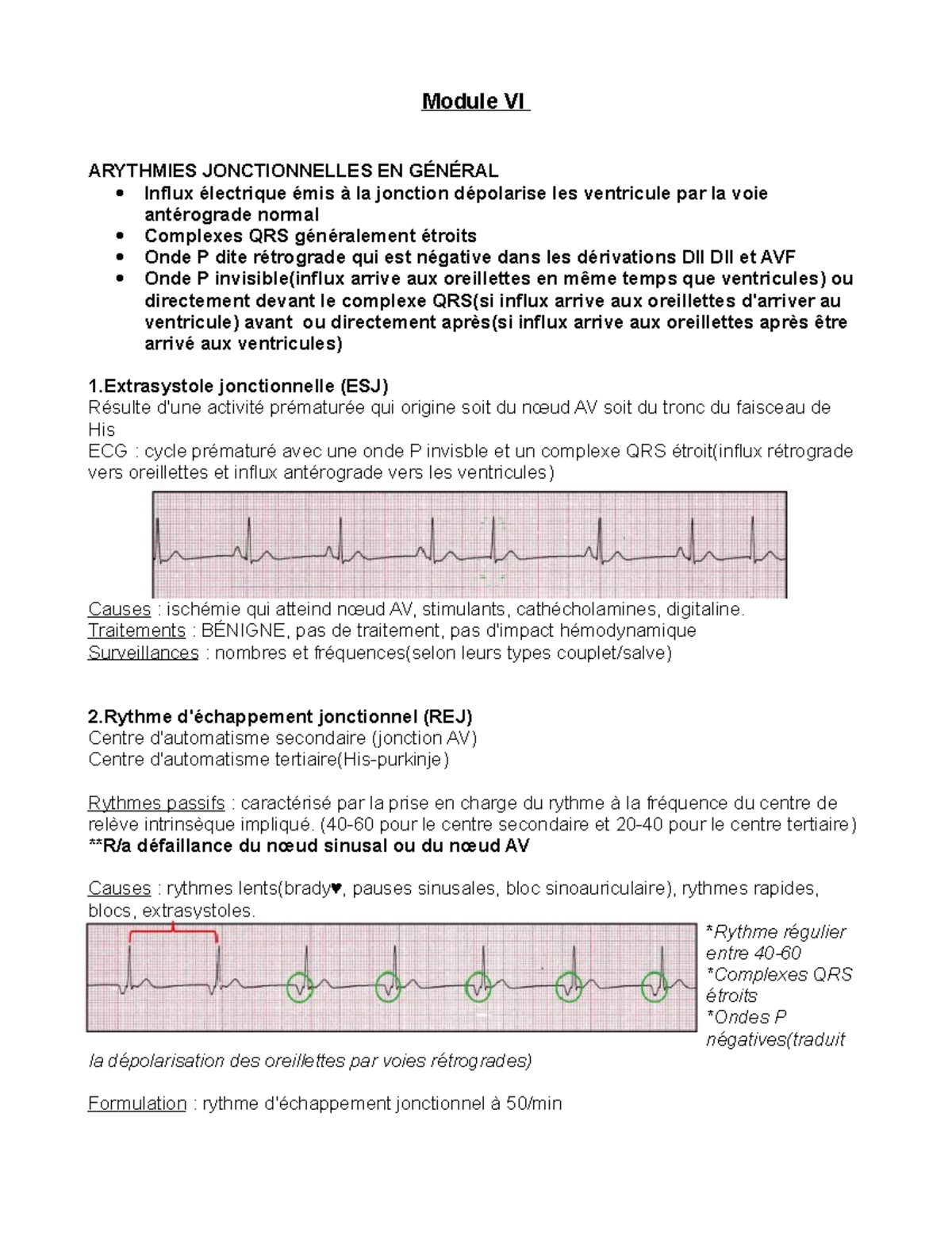 Module Vi Notes De Cours Cours Module Vi Arythmies Jonctionnelles