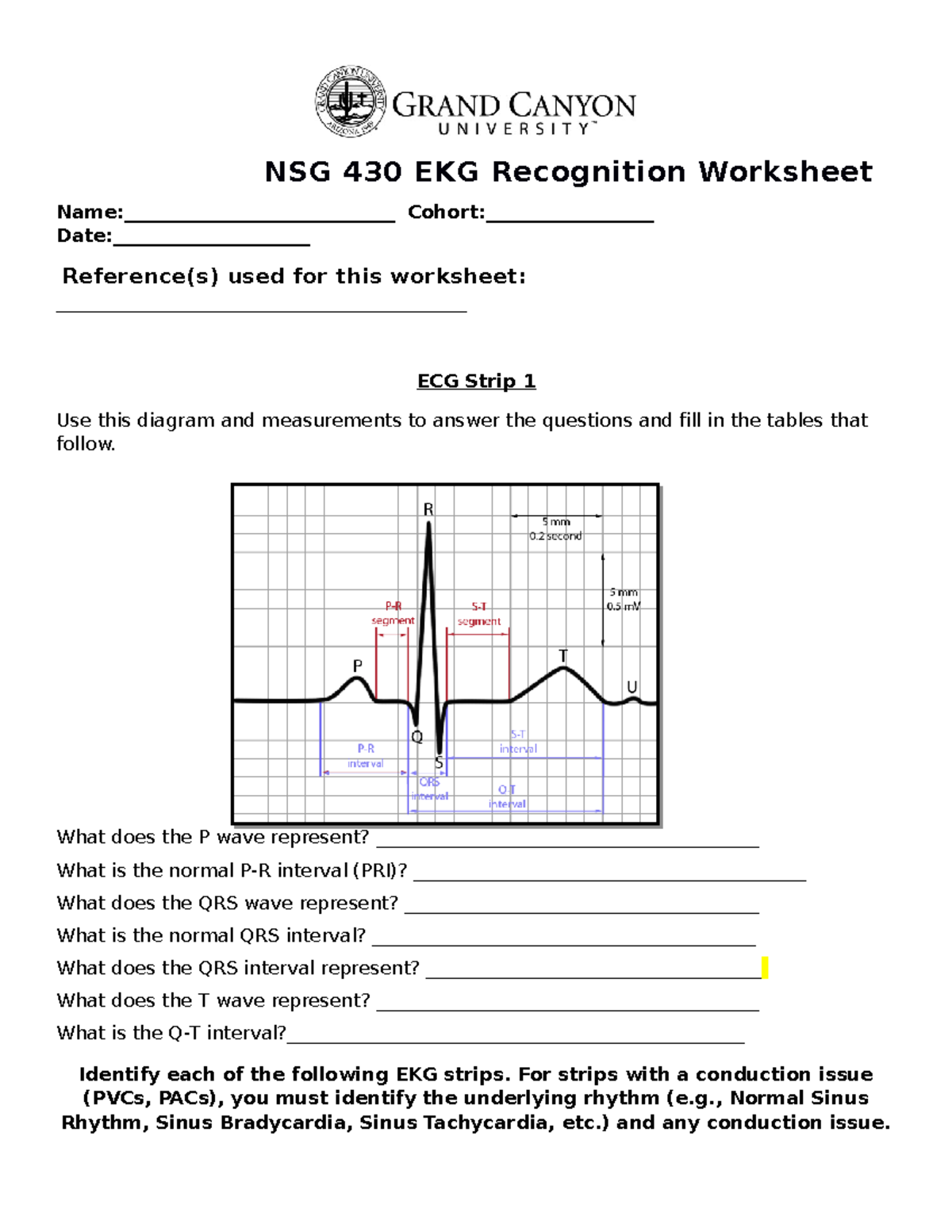 Practice ECG Worksheet - NSG 430 EKG Recognition Worksheet Name