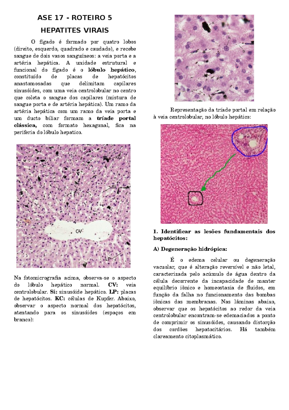 Resumos Sobre Histologia Das Hepatites Virais Studocu