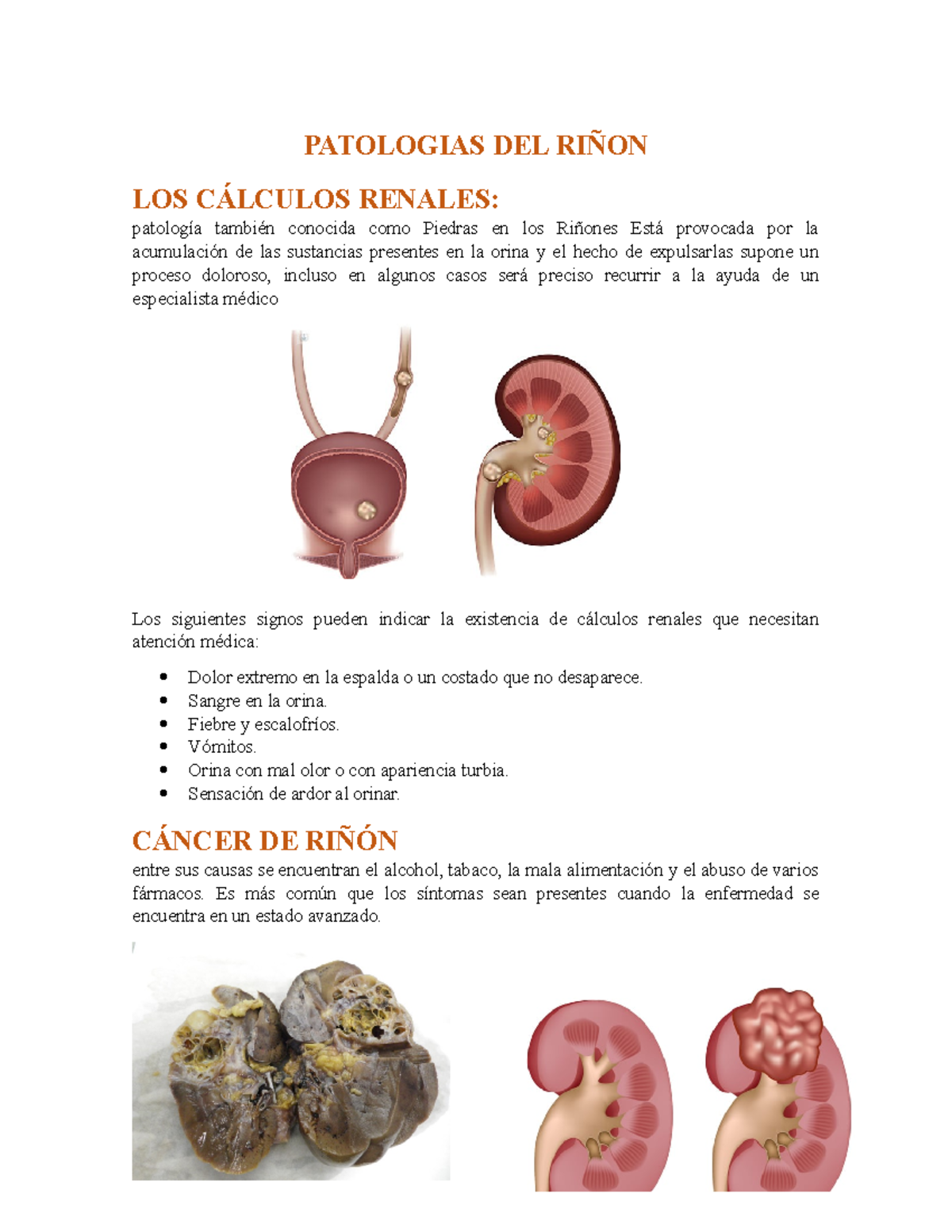 Patologias DEL Riñon - Trabajo sobre el riñón muy importante ...