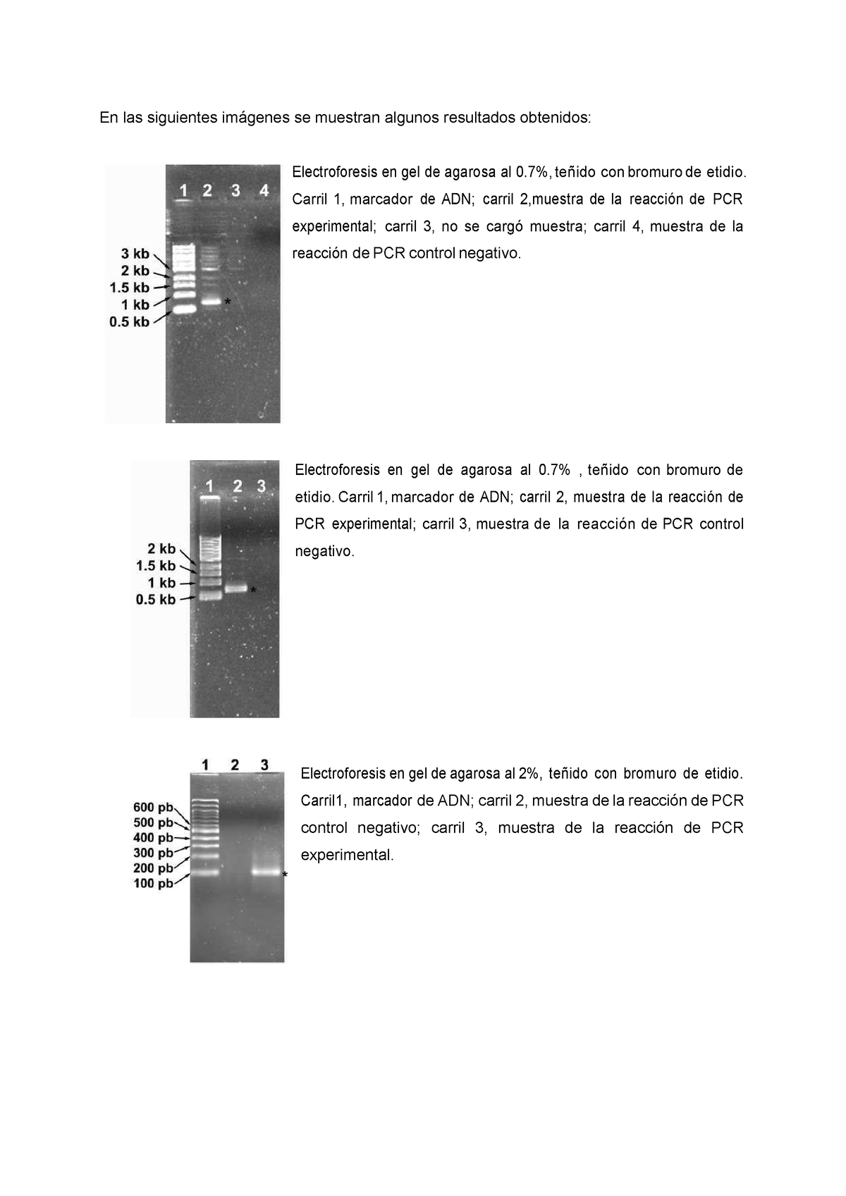 Resultados Pcr Electroforesis Para Tamaño De De Primers En Las Siguientes Imágenes Se 0004