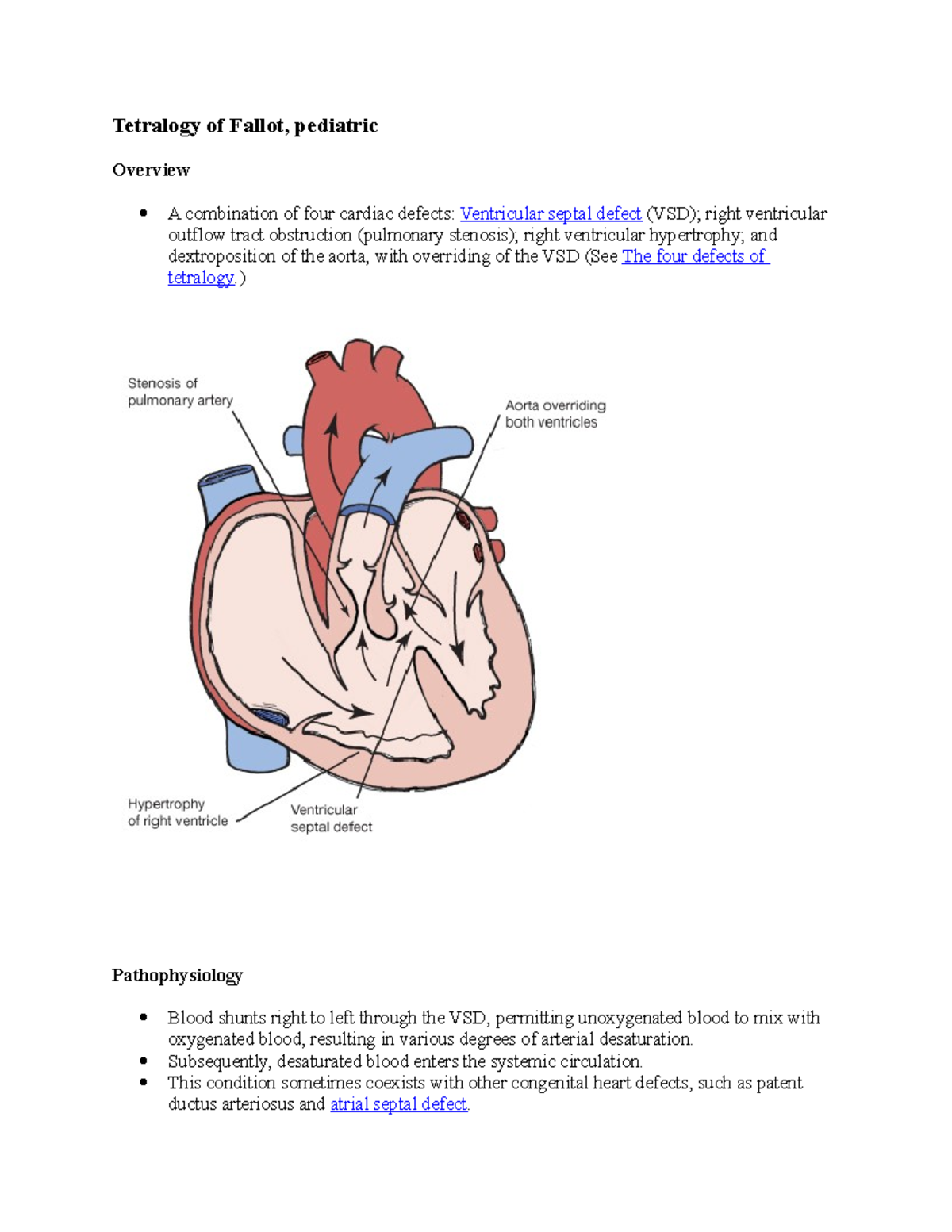 Tetralogy Of Fallot - N/a - Tetralogy Of Fallot, Pediatric Overview A ...