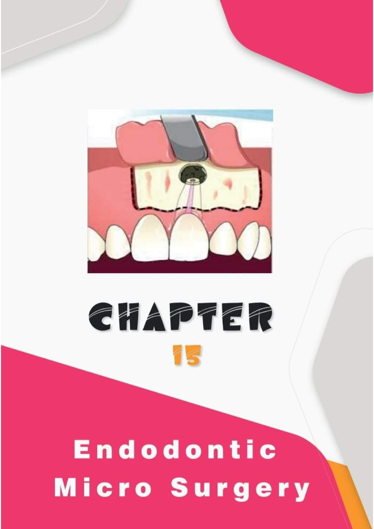 Endodontic Microsurgery - Dental Anatomy - Studocu