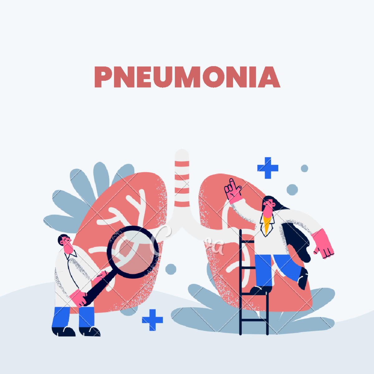 Pneumonia - PNEUMONIA ####### PNEUMONIA CAN BE CAUSED BY VARIOUS ...