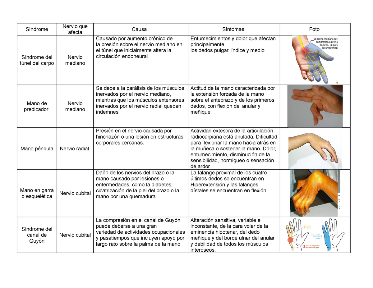 lesión del nervio mediano mano