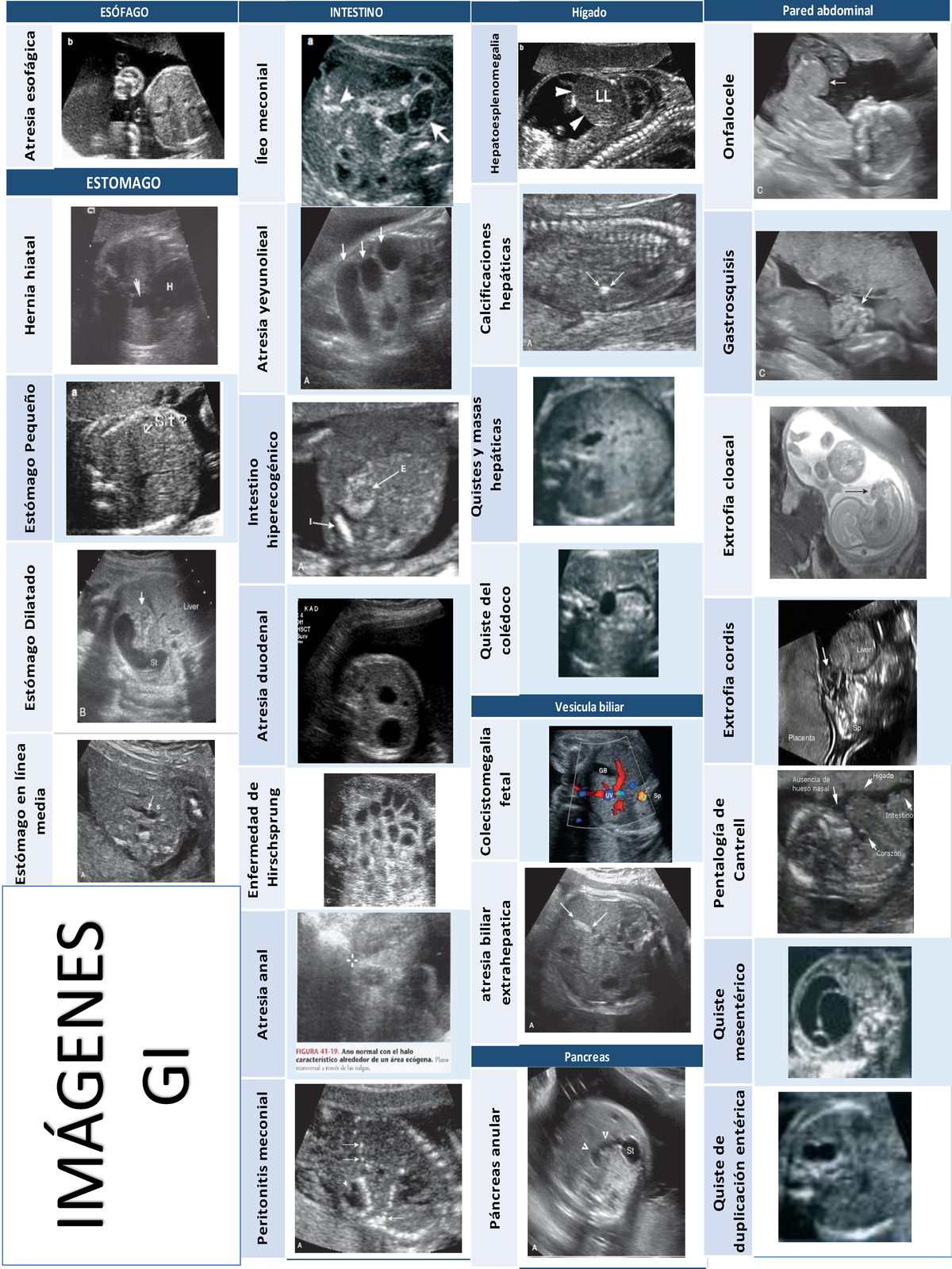 Resumen Gi Gu Obstetrie En Gynaecologie Studocu