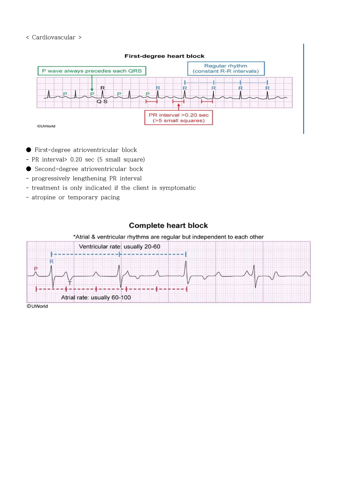 uworld-nclex-nursing-first-degree-atrioventricular-block-pr