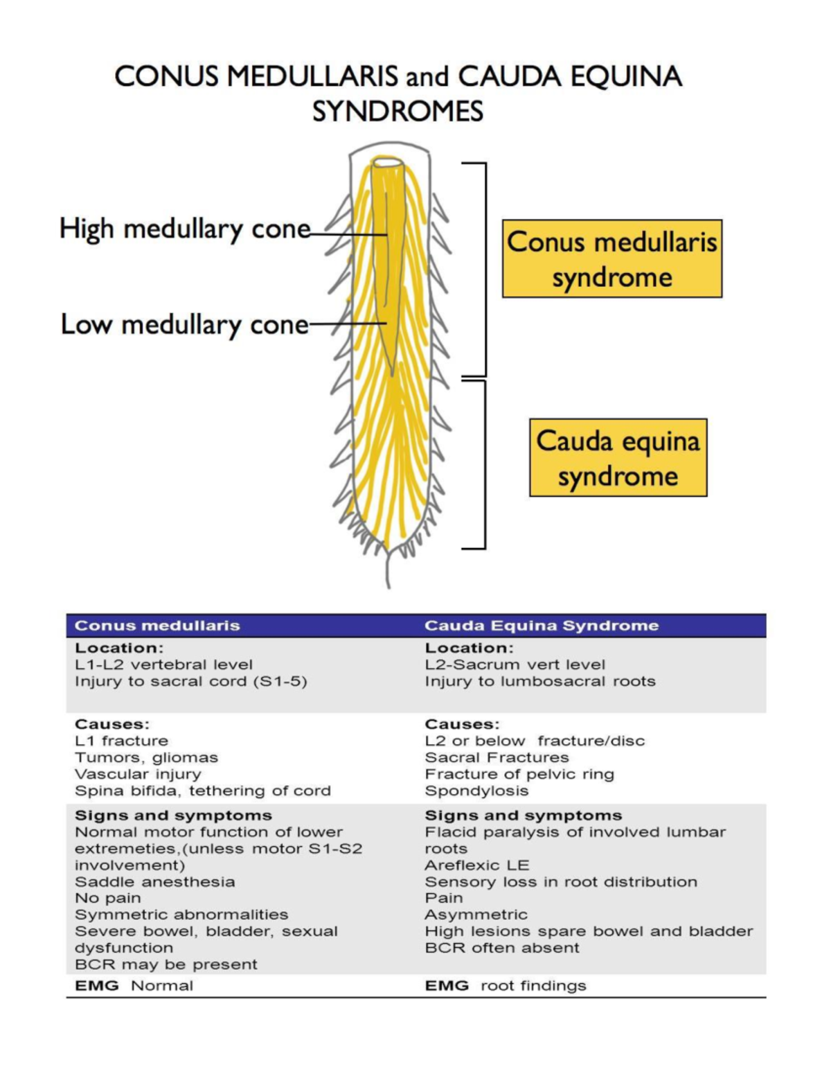 Cauda Equina Syndrome Vs Conus Medullaris Syndrome 1159