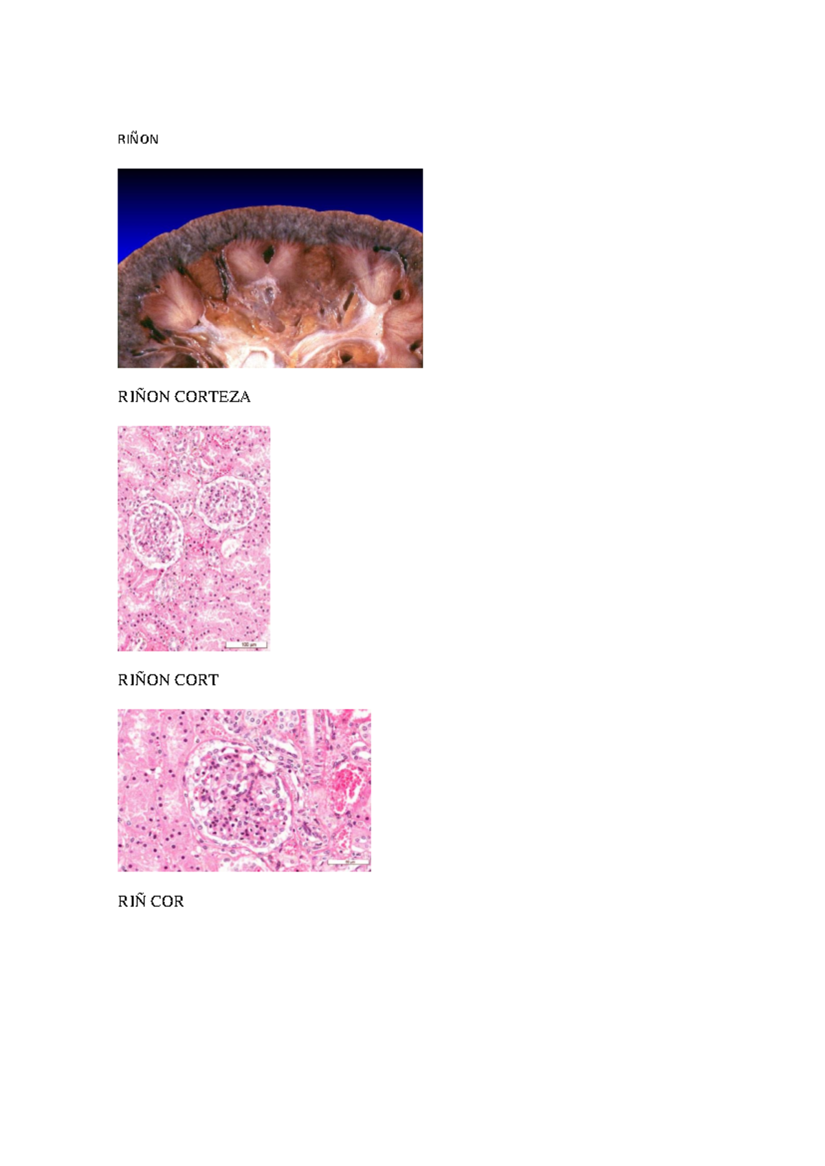 Histologia Urinario - LAB Histología - RIÑON RIÑON CORTEZA RIÑON CORT ...