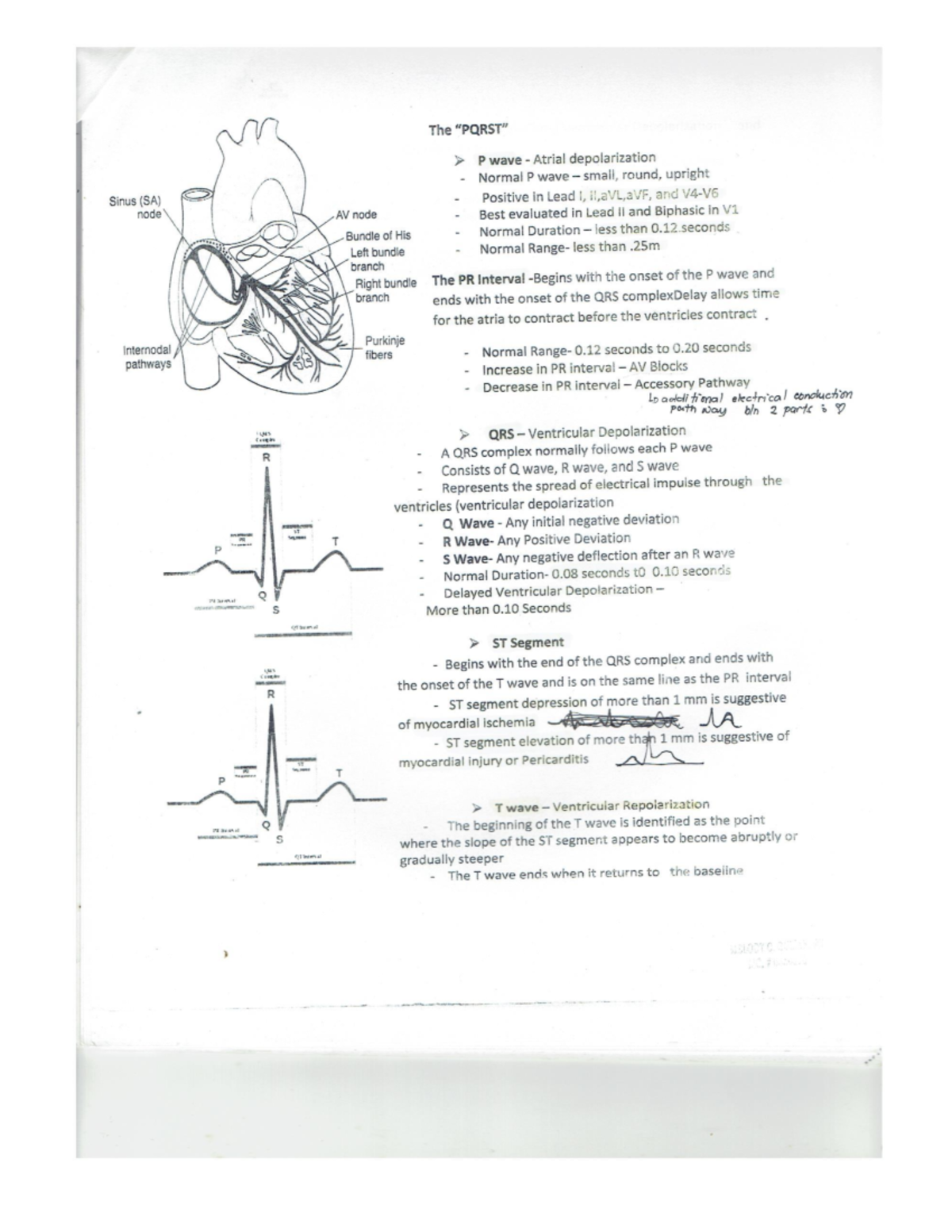 Identifying the PQRST of the ECG strip - ECG reading - Studocu