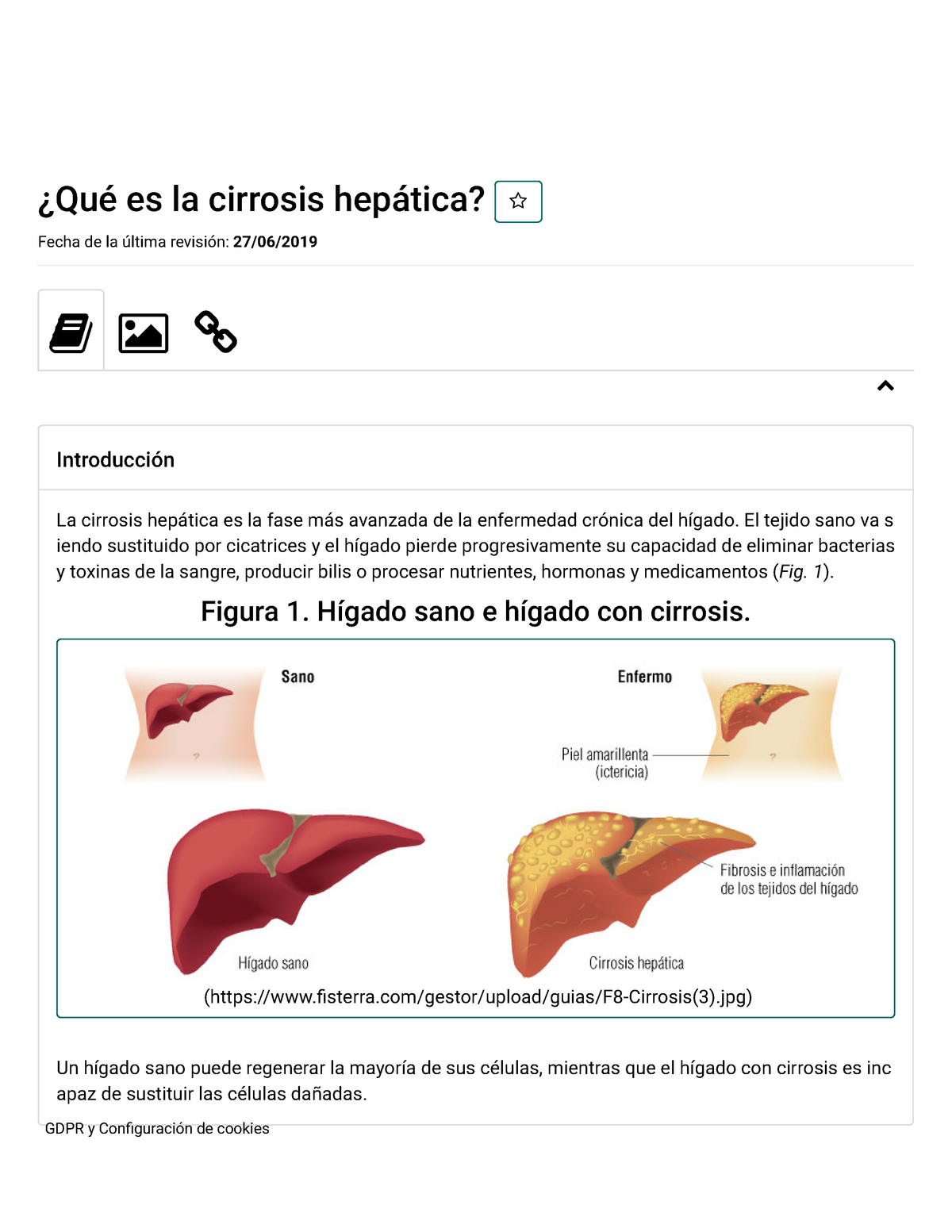 cirrosis del higado vs higado sano