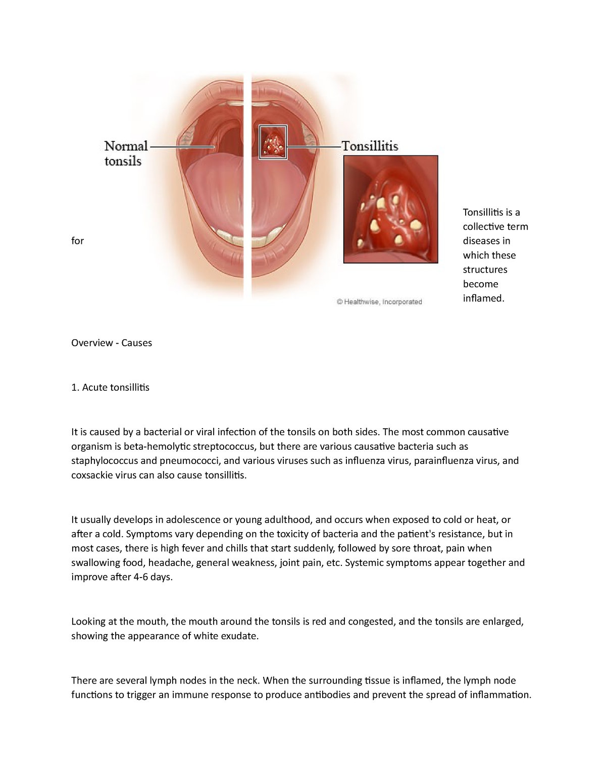 tonsillectomy-3-tonsillitis-is-a-collective-term-for-diseases-in