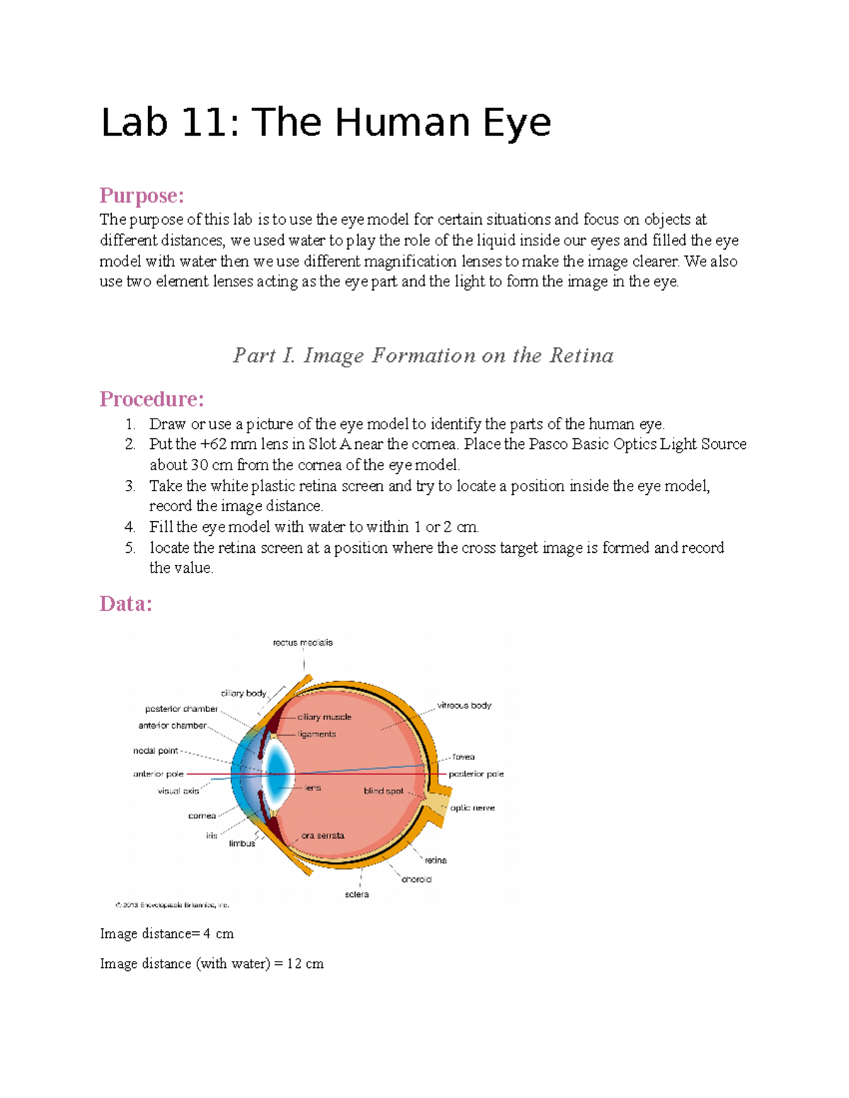 case study question on human eye