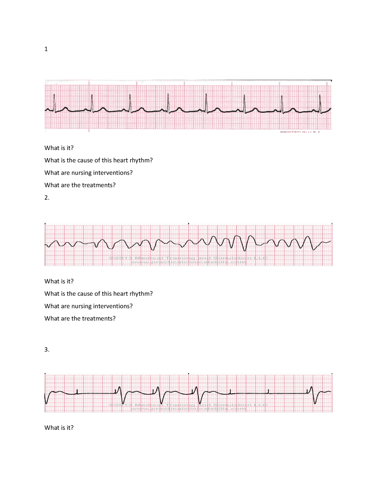 Dysrhythmias Practice - 1 What Is It? What Is The Cause Of This Heart 