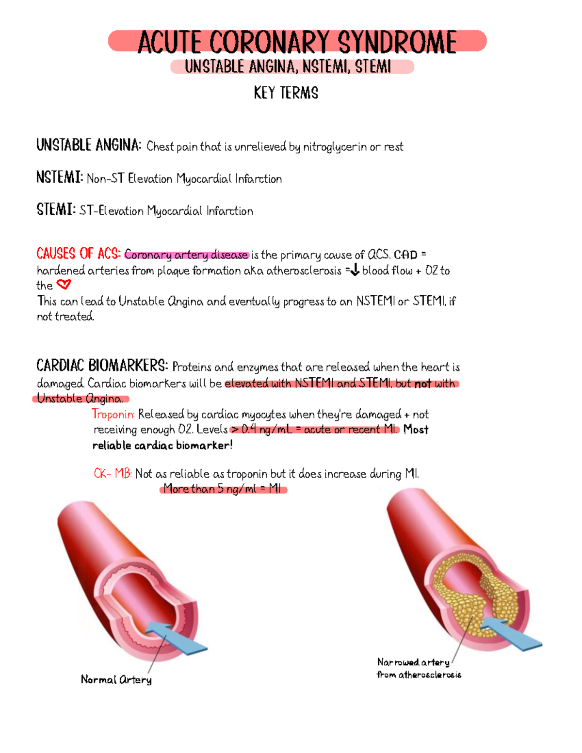 non stemi vs nstemi