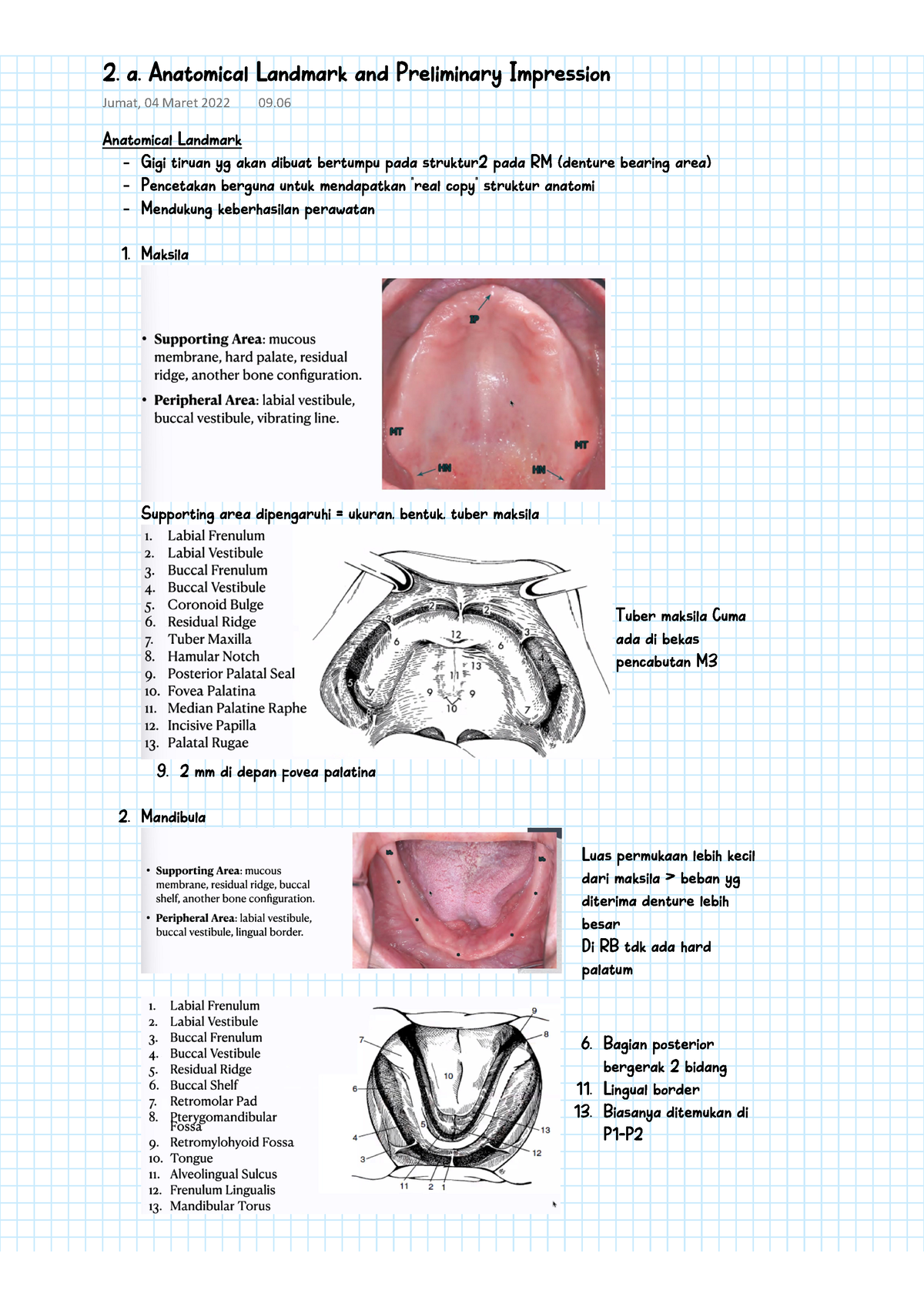 Prostodonsia II - 2. A. Anatomical Landmark And Preliminary Impression ...