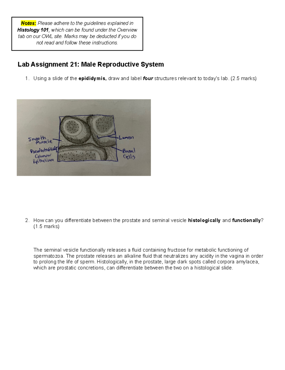 Lab 21 assignment FW22 23 Lab Assignment 21 Male Reproductive System Using a slide of the