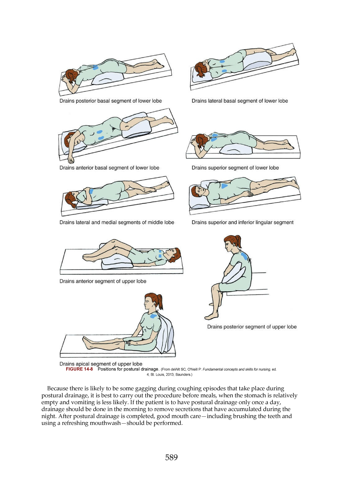 Nursing-197 - N/A - FIGURE 14-8 Positions for postural drainage. (From ...