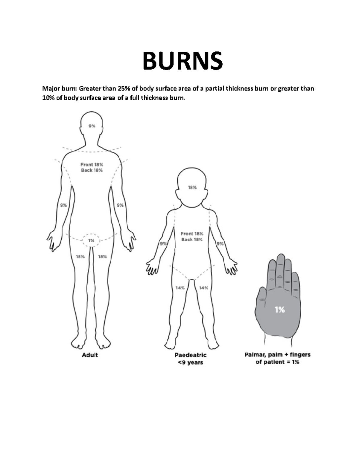 Burns BURNS Major burn Greater than 25 of body surface area of a