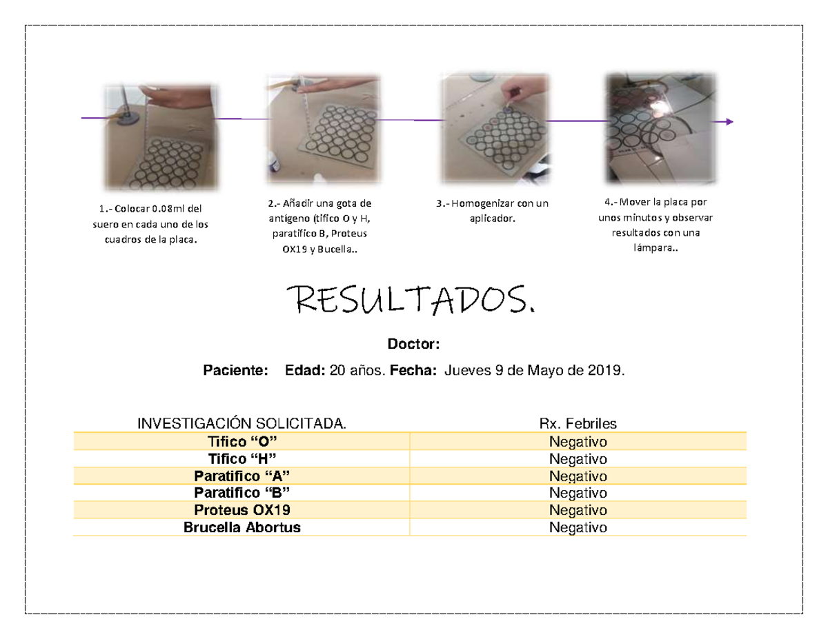 Reacciones Febriles Warning TT undefined function 32 1. Colocar 0 del suero en cada uno de