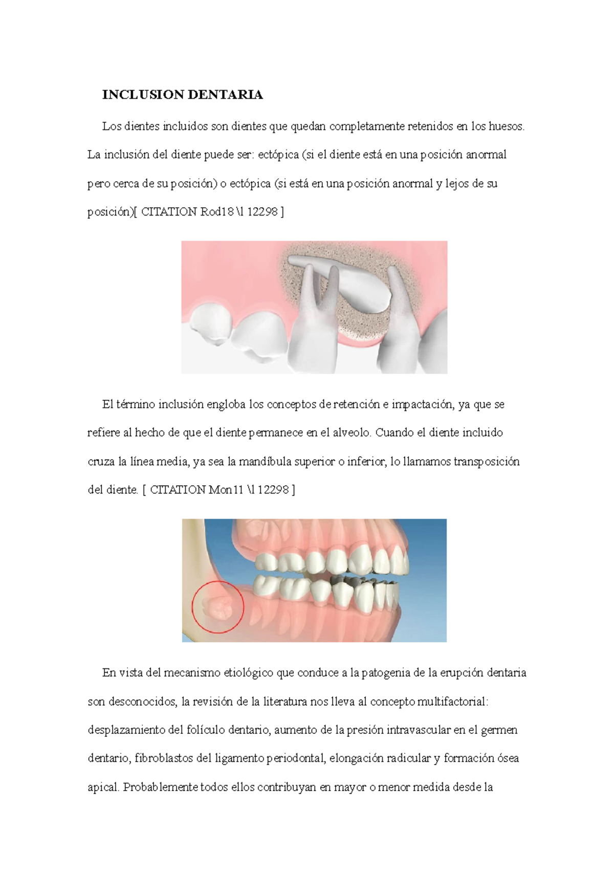 Inclusion Dentaria DESCRIPCION Y ANALISIS INCLUSION DENTARIA Los