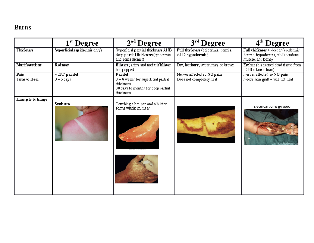 NUR 252 SI Burn Table Key 2020-2021 Patho - Burns 1 st Degree 2 nd ...