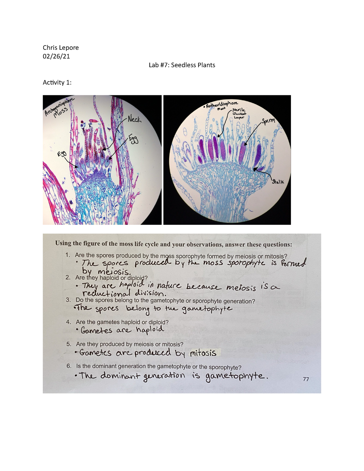 Lab7 Seedless Plants Biology 2 Lab 7 With Answers Chris Lepore Lab Seedless Plants Activity