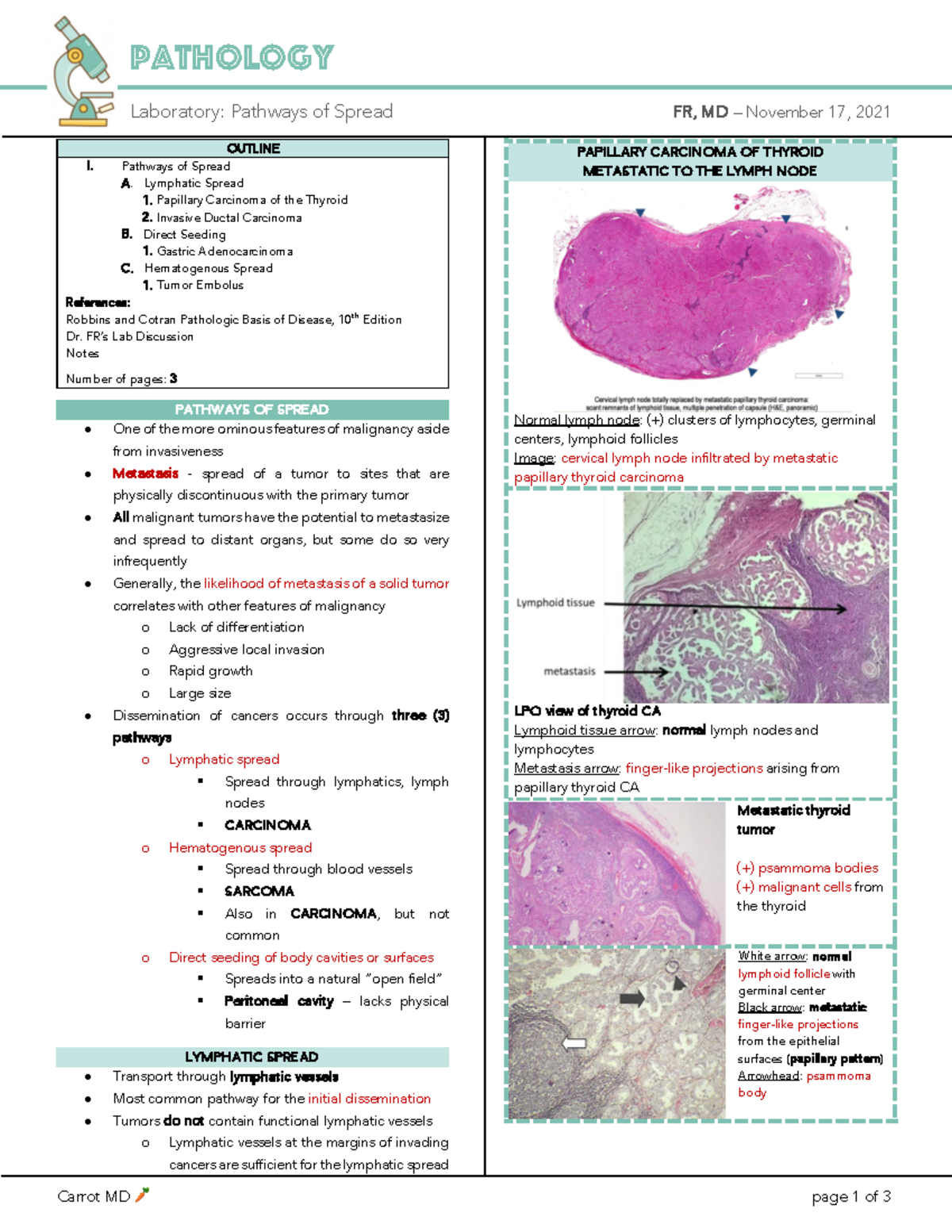 pathways-of-spread-pathways-of-spread-a-lymphatic-spread-papillary