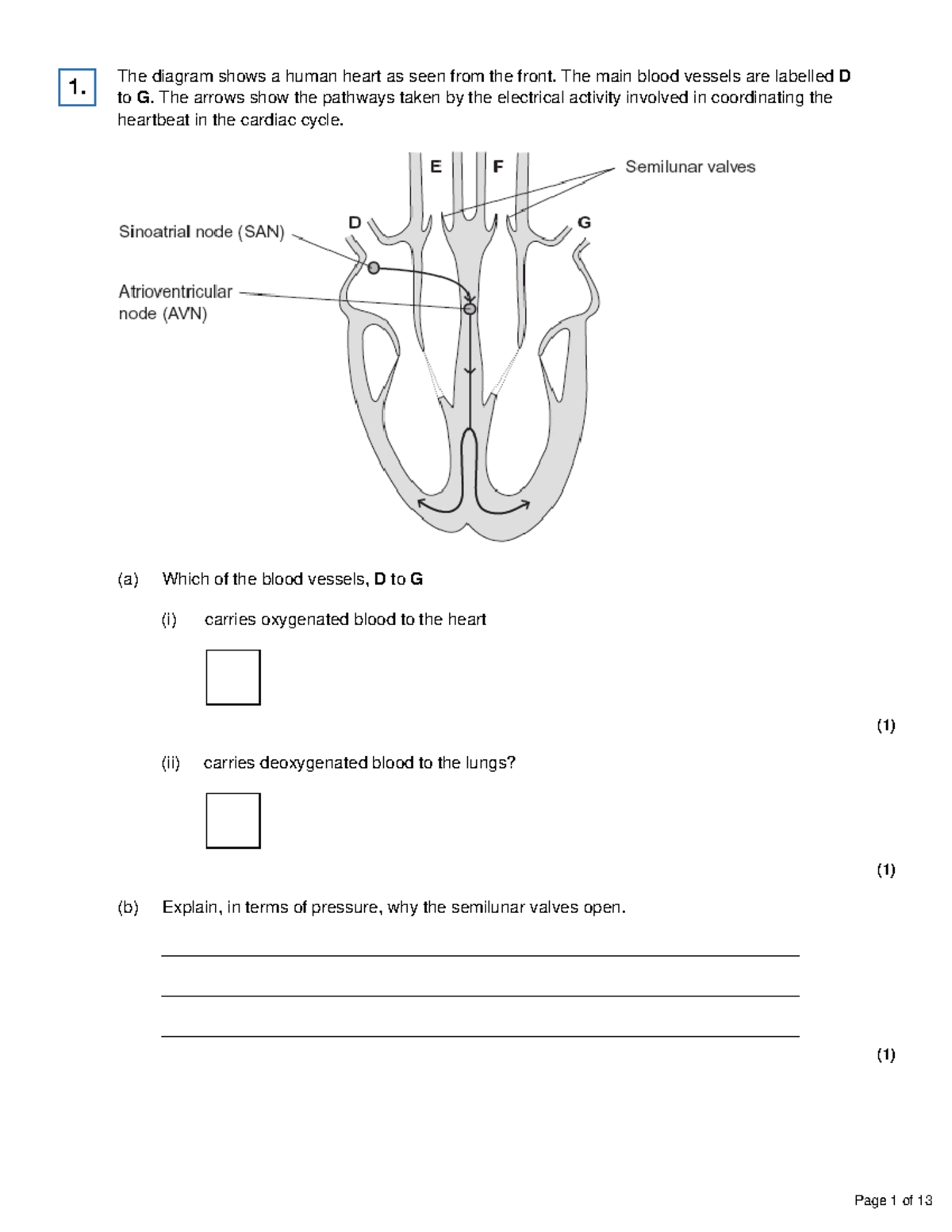 2Receptorsandthecontrolofheartrate(import) - The diagram shows a human ...