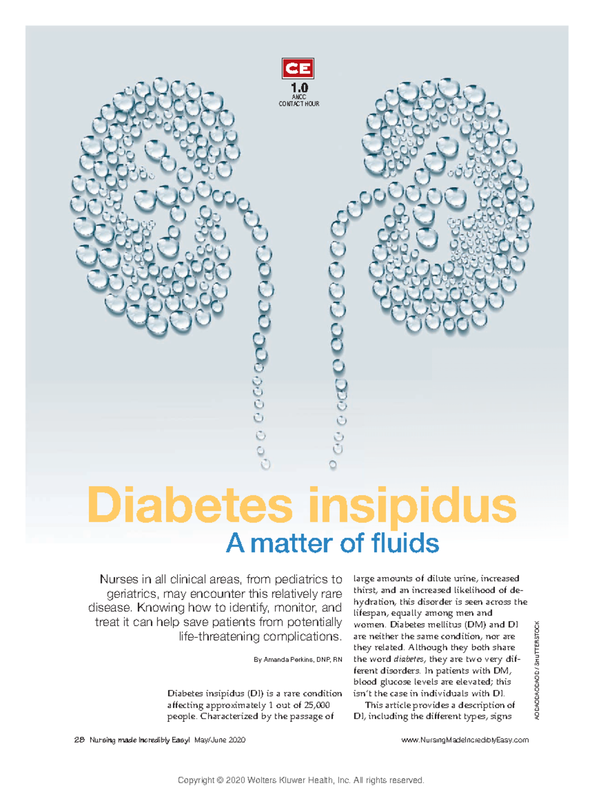 Diabetes insipidus A matter of fluids 28 Nursing made Incredibly Easy