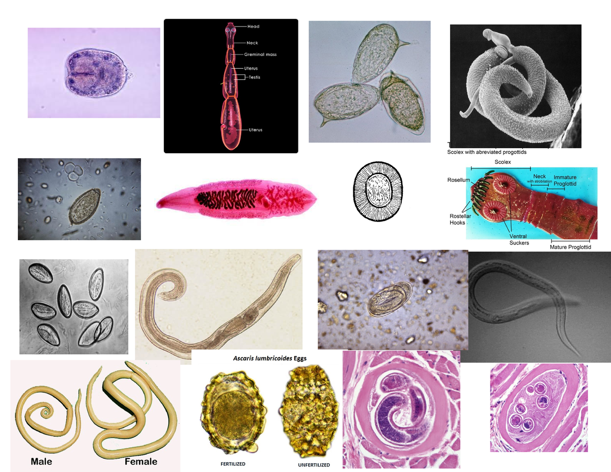 Microbiology - Helminthes, protists and paramecium images. - BIO 244 ...