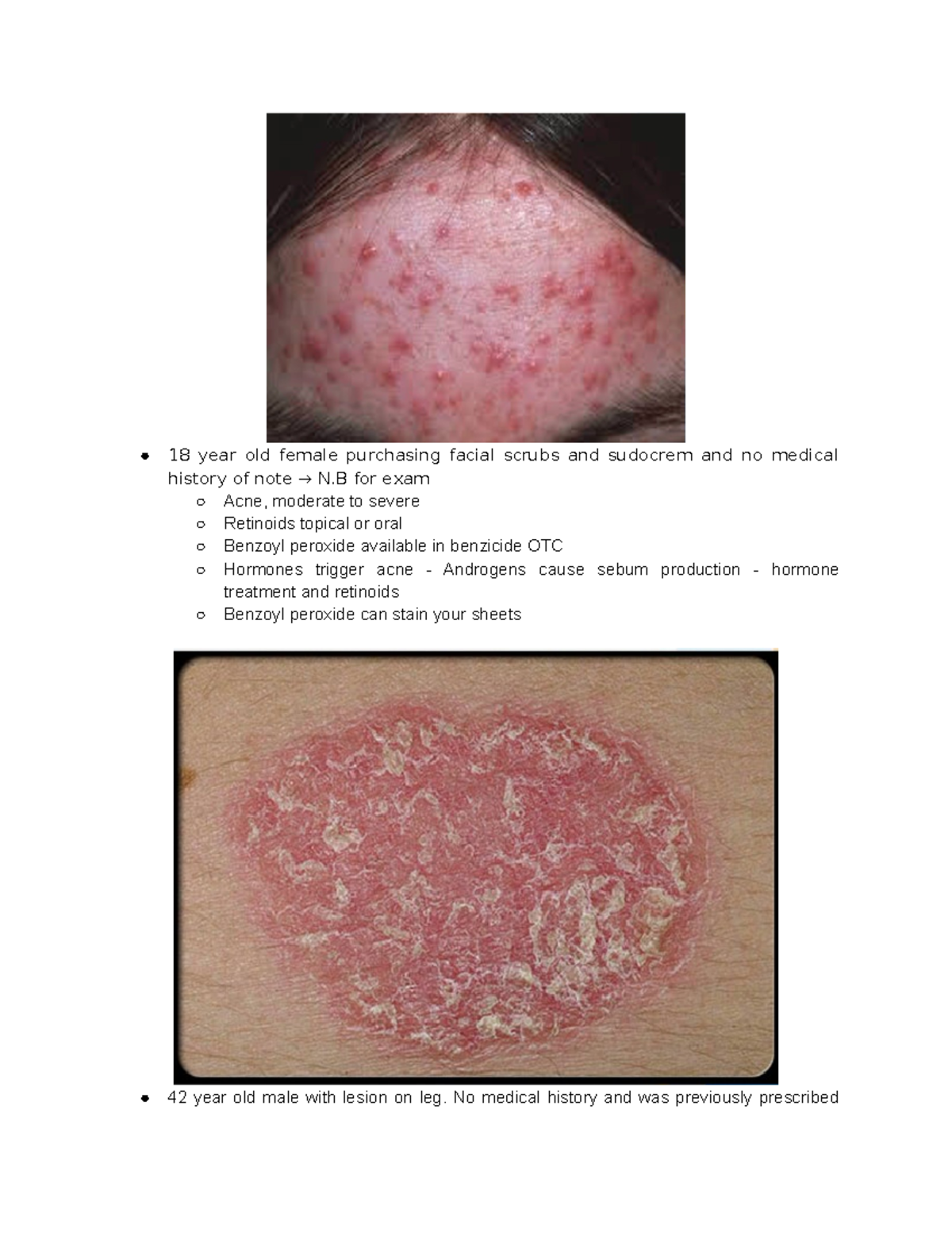 benzoyl peroxide sudocrem