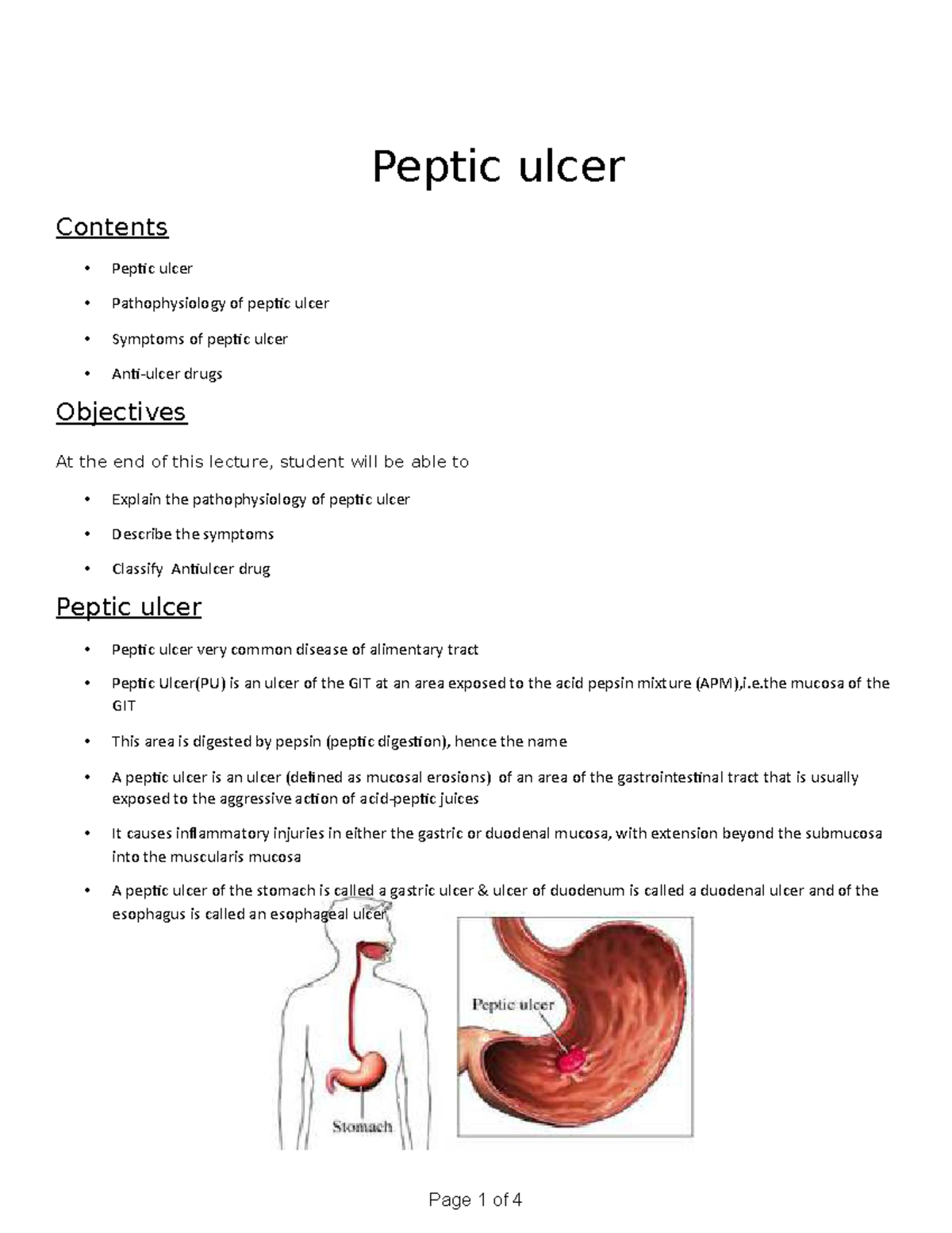 Chapter 31 Pathophysology Of Ulcer Peptic Ulcer Contents • Peptic Ulcer • Pathophysiology Of