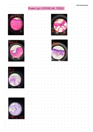 Histology - Notes - EPITHELIAL TISSUE SIMPLE SQUAMOUS EPITHELIUM Human ...