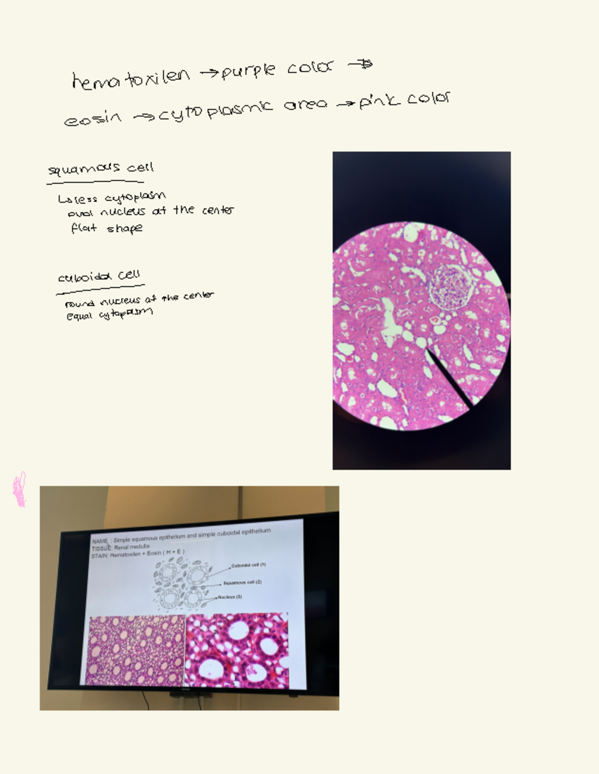 Lab - Lab - hematox!len-purple color - es!n - > cytoplasm!c area - > p ...