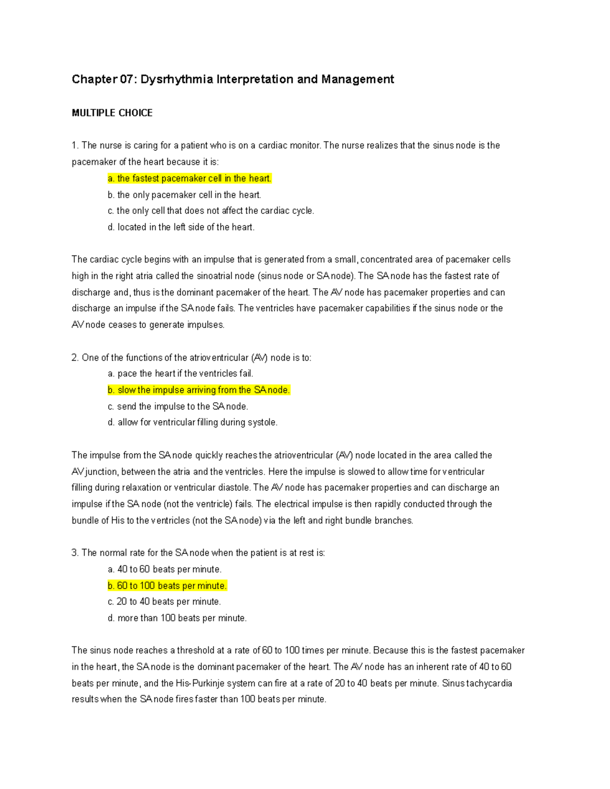 EXAM 4 Study Guide - Chapter 07: Dysrhythmia Interpretation And ...