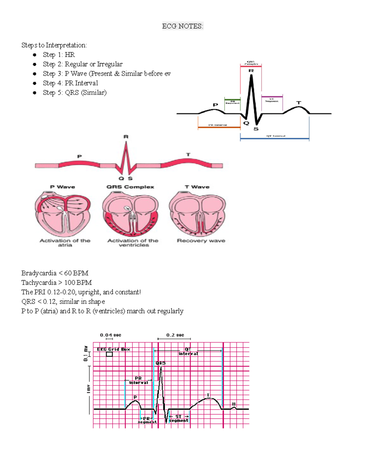 ECG Notes ECG NOTES Steps to Interpretation Step 1 HR Step 2 Regular or Irregular Step